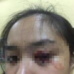 ‘Dianiaya Hingga Nyaris Buta’ AM Lapor Polisi