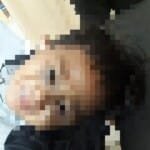 Bocah 2,5 Tahun Disiksa Ayah Tirinya Hingga Patah Kaki