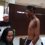 Anak Disiram Cuko Parah Sang Ibu Berang Lapor Polisi