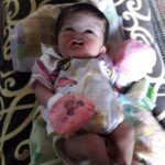 Kasihan Bayi ini Lahir Tanpa Anus dan Hidung