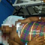 Pasutri Nyaris Tewas