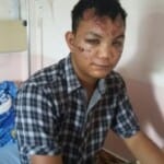 Diduga Salah Tangkap, Haris Dianiaya dan Dipaksa ‘Ngaku’ Oleh Polisi