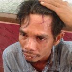 Serempetan Motor, Warga Lorong Perguruan Dianiaya