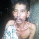 Alami Penyakit Komplikasi, Saudiki Butuh Bantuan Dermawan