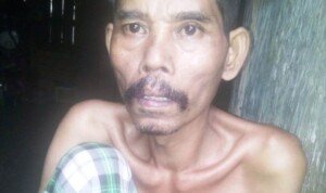 Alami Penyakit Komplikasi, Saudiki Butuh Bantuan Dermawan