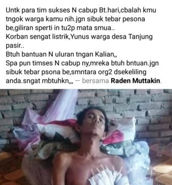 Kedua Kaki Diamputasi Usai Tersengat Listrik, Warga Batanghari Butuh Bantuan