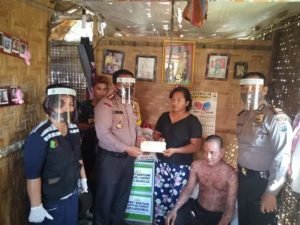 Kapolres Langkat AKBP Edi S Sinulingga ,SIK Berikan Bantuan Dari Kapolda Sumut Kepada Penderita Penyakit “Sindrom”