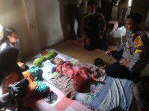 Kapolres Ogan Ilir Gendong Bocah Penderita Tumor Wajah Naik Ambulans