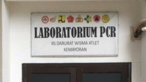 Ini Perbedaan Rapid Test Antigen, Rapid Test Antibodi dan Swab PCR