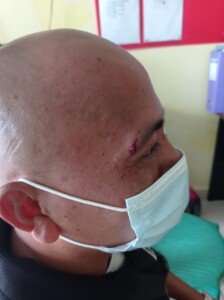 Wartawan Dianiaya, Polisi Langsung Proses Laporan