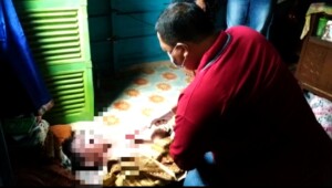 Epilepsi Kambuh, Atta Ditemukan ‘Ngambang’
