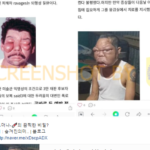 Hoax !! Foto 2 Pria Mata Bengkak Akibat Efek Samping Vaksin Moderna Covid-19