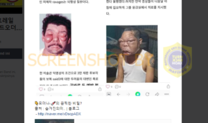 Hoax !! Foto 2 Pria Mata Bengkak Akibat Efek Samping Vaksin Moderna Covid-19