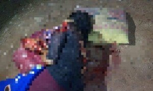 Diduga Cemburu, Suami Nyaris Habisi Nyawa Isteri dengan Tebasan Parang