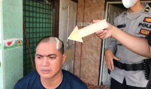 Pemilik Lahan Parkir Pasar Sako Dibacok Pedang