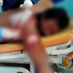 Gegara Tersinggung Tukang Parkir di Mamuju Tebas Tukang Ojek