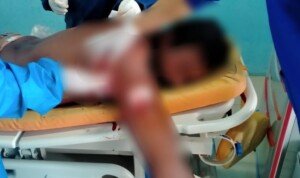 Gegara Tersinggung Tukang Parkir di Mamuju Tebas Tukang Ojek
