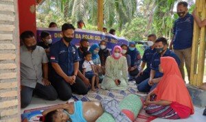 Leting TFTT Polres Labuhanbatu Bantu Pengobatan Anak Penderita Tumor