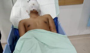 Wartawan di Medan Disiram Air Keras