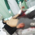 Diduga Rebutan Lahan Parkir Pasar 26 Ilir, Dua Pemuda Nyaris Tewas Dikeroyok