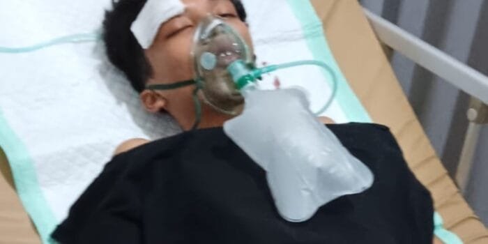 Dikeroyok 10 Pelaku, Anak Wartawan Kritis