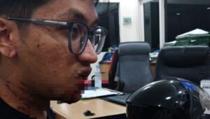 Dikeroyok Geng Motor, Mahasiswa Unsri Pecah Bibir
