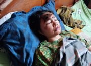 Ulah Jambret, Ibu dan Anak Terseret Sepeda Motor