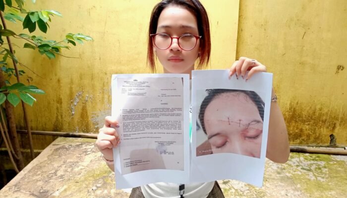 Polisi Masih Buru Pelaku Penganiayaan Dalam Kamar Hotel