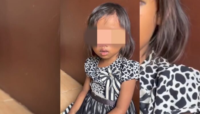 Misteri Mata Lebam Siswa SDN 150 Palembang, Orang Tua Meradang