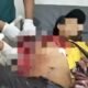 Pedagang Pecel Lele di Palembang Jadi Korban Pembacokan Sekelompok Remaja