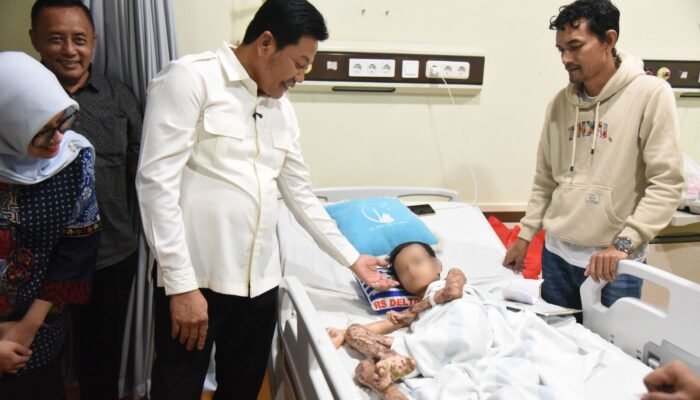 Bupati Subandi Pastikan M. Izzan Korban Luka Bakar 46 Persen Dapat Perawatan Maksimal di RSUD Notopuro