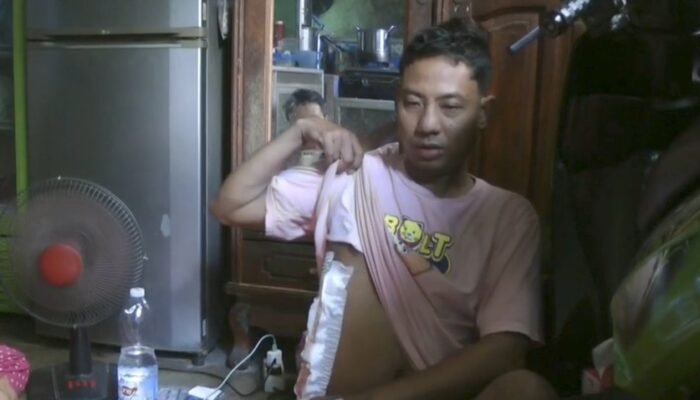 Berhadapan Dengan Pelaku Curanmor, Reza Pahlepi Alami Luka Tembak