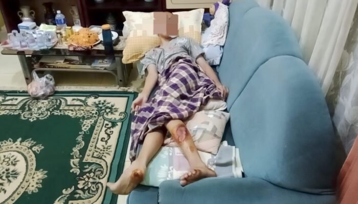 Anak Yatim-Piatu Jago Taekwondo Nekat Lawan 2 Jambret Bersajam di Sekip Palembang